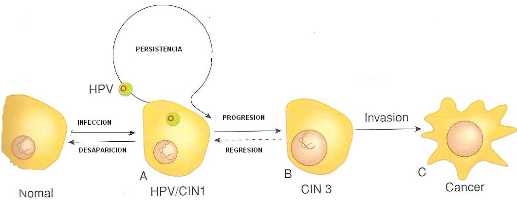 papiloma virus genotipo 51)